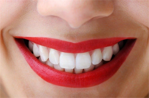Bạn có biết cách cải thiện nụ cười của mình?