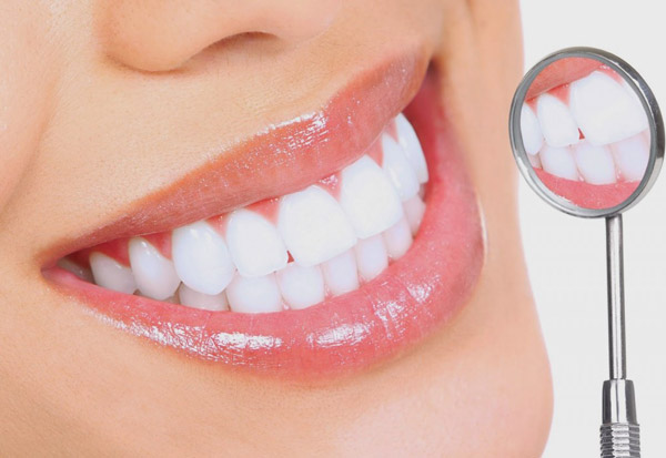 Lợi và hại khi tẩy trắng răng | VTC